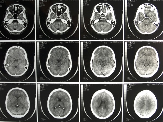 Image: brain scan